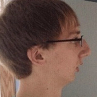 ErmTheWorm