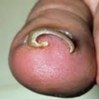 StubbedToe